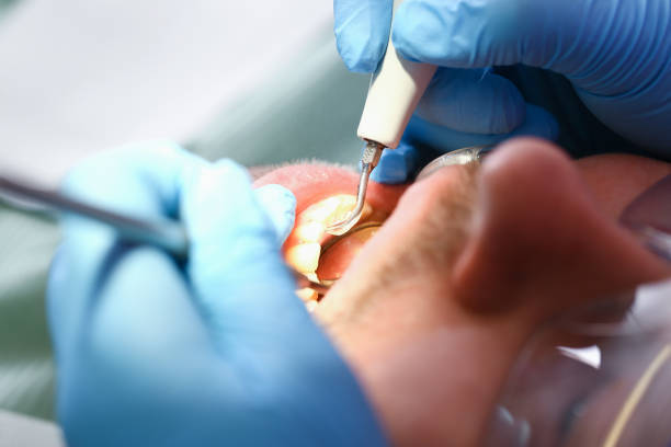 Best Cosmetic Emergency Dentistry in Weidman, MI