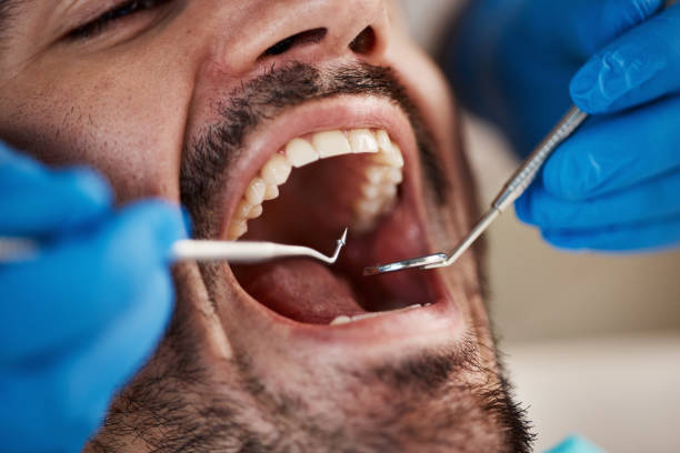 Best Emergency Tooth Extraction in Weidman, MI